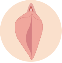 비대칭 소음순
